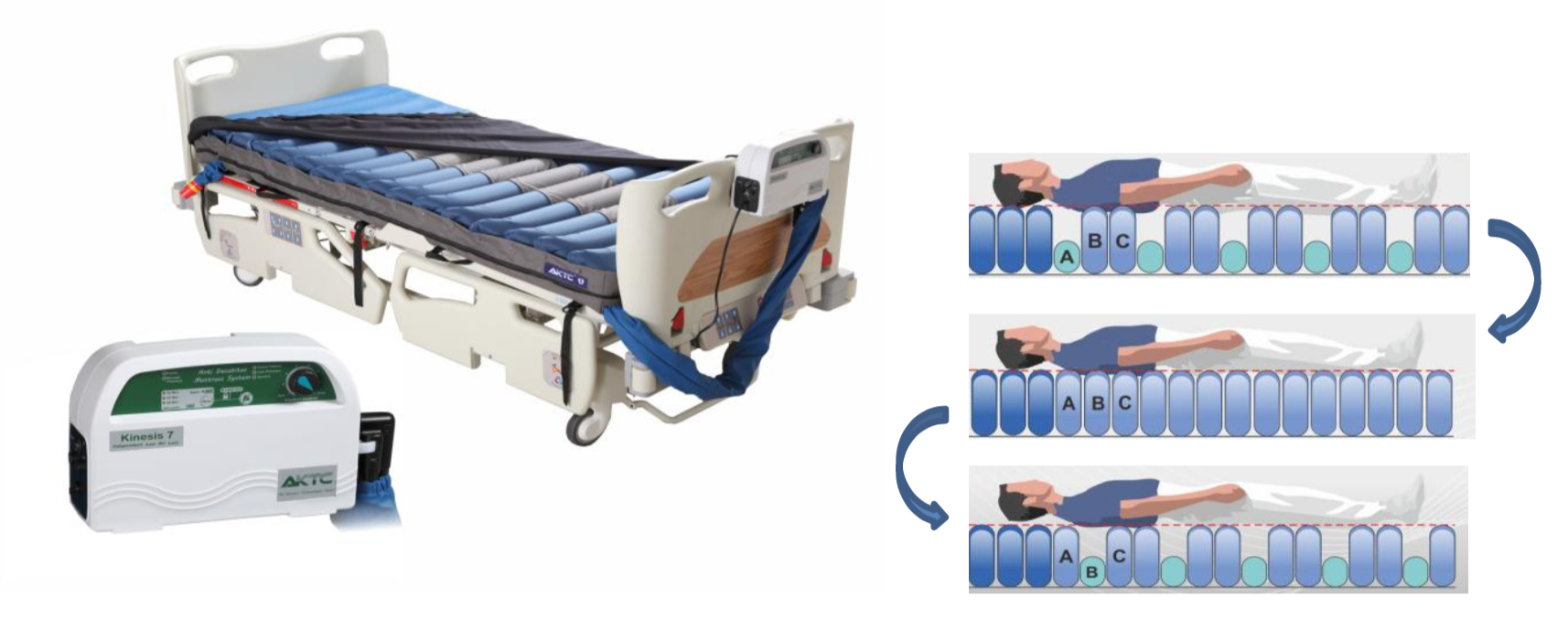 alternating air mattress